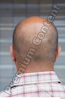 Street  639 bald hair head 0001.jpg
